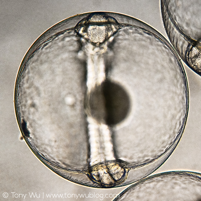 Symphorichthys spilurus embryo